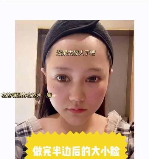 苹果手机后置拍照出现大小脸怎么办？如何解决？  第3张