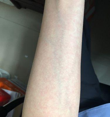 “换胳膊”是什么意思？在电视领域中指的是什么？  第2张